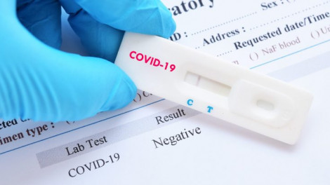Viện Pasteur TPHCM có thực hiện dịch vụ xét nghiệm COVID-19 cho người dân?