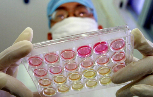 Mầm bệnh COVID-19 đã âm thầm lây lan nhiều năm?