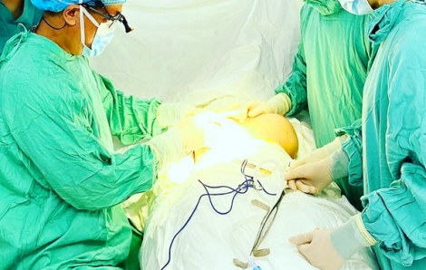 Một phụ nữ ở Huế vỡ túi ngực sau 10 năm phẫu thuật thẩm mỹ