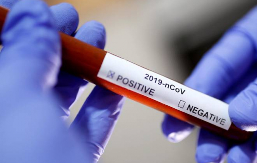 Ấn Độ “ngậm đắng” nhập bộ xét nghiệm nhanh COVID-19 từ Trung Quốc