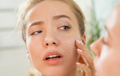 Hiểu làn da khô và bí quyết giúp da mềm mại