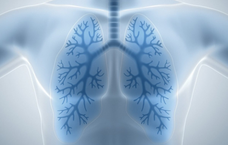 Có những yếu tố nào ảnh hưởng đến khả năng sống sót của một người sau khi mất một lá phổi?
