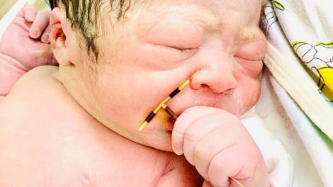 Hình ảnh bé sơ sinh ở Hải Phòng cầm vòng tránh thai, "phá tan" kế hoạch của bố mẹ