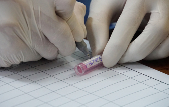 “Bom dịch COVID-19” sẽ nổ bất kỳ lúc nào