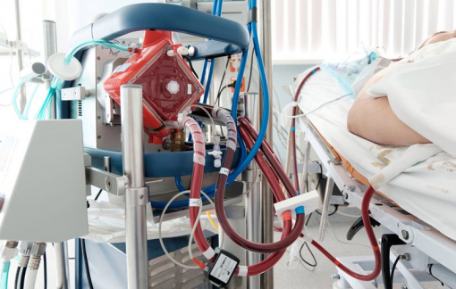 Việt Nam lên kế hoạch nhập thêm máy ECMO để điều trị cho bệnh nhân nặng