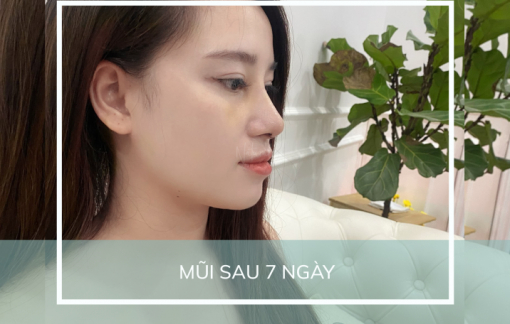 Thẩm mỹ viện Natural - địa điểm dành riêng cho giới mộ điệu nâng mũi