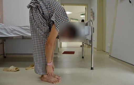 Chế tạo dụng cụ riêng để chữa cho người đàn ông gập lưng như con tôm