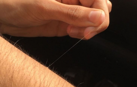 Vì sao trên cơ thể chúng ta thường xuất hiện một số sợi lông siêu dài?
