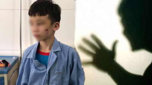 Quen đánh đấm người khác: "Khó ở" trong người hay mắc bệnh tâm thần?