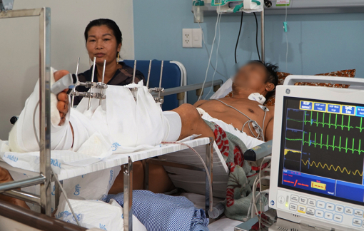 Người đàn ông bị kẻ lạ xông vào nhà chém đứt lìa chân rồi bỏ đi