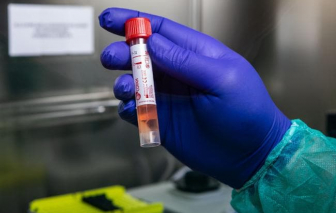 SARS-CoV-2 xuất hiện ở Ý trước cả ca nhiễm tại chợ thủy sản Vũ Hán, Trung Quốc?