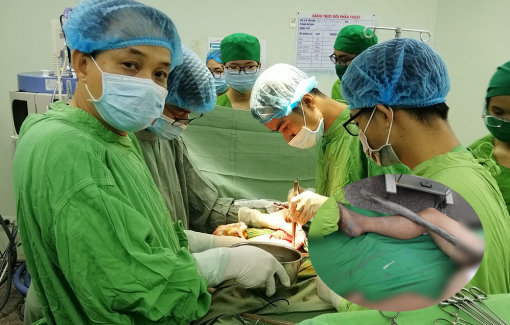 Đang tắm bị cọc gỗ đâm từ mông xuyên lên bụng