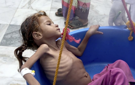 Mỹ và phương Tây cắt viện trợ nhân đạo, hàng triệu trẻ em Yemen kêu cứu
