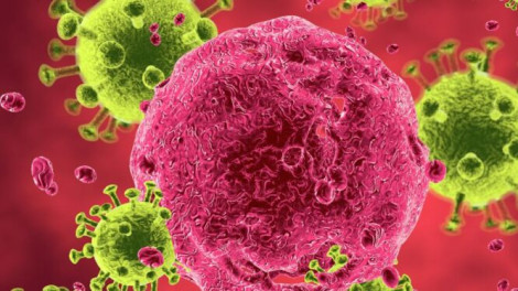 Tác động từ HIV có thể khiến bệnh nhân suy giảm trí tuệ sớm