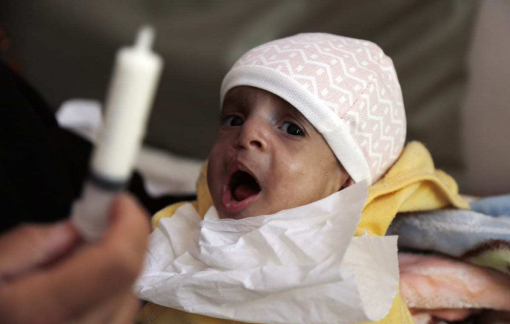 Ít nhất 400.000 trẻ em Yemen dưới 5 tuổi có thể chết đói trong năm nay
