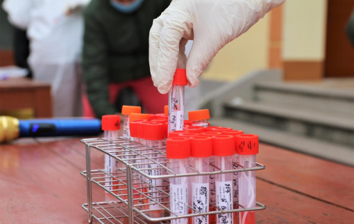 TPHCM ghi nhận thêm 2 trường hợp nghi mắc COVID-19