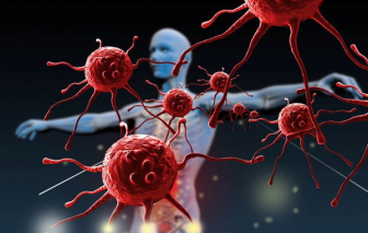 COVID-19 có thể gây hoại thư