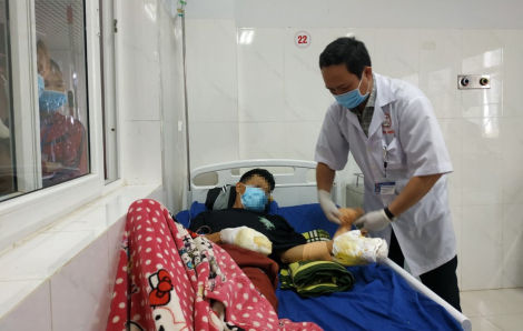 Chơi pháo nổ ngày tết, nạn nhân ở Đắk Lắk bị tai nạn phải cắt bỏ bàn tay