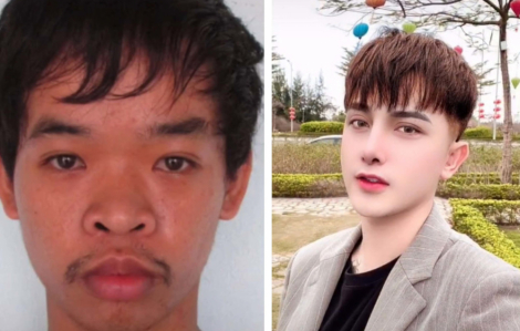 Chàng trai 9x Việt gây chú ý trên báo Hàn khi nhiều lần phẫu thuật để giống thần tượng K-pop