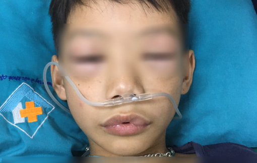 Bé 10 tuổi sốc phản vệ sau khi uống thuốc ho sốt