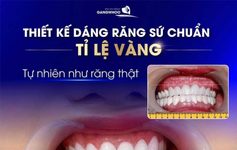 Đến Bệnh viện thẩm mỹ Gangwhoo trồng răng implant, cười đẹp như tranh