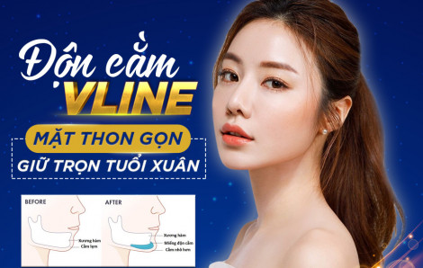 Độn cằm nội soi: mặt V-line chuẩn sao Hàn