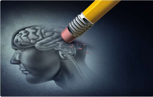 Mỹ chấp thuận thuốc điều trị bệnh Alzheimer mới sau gần hai thập niên