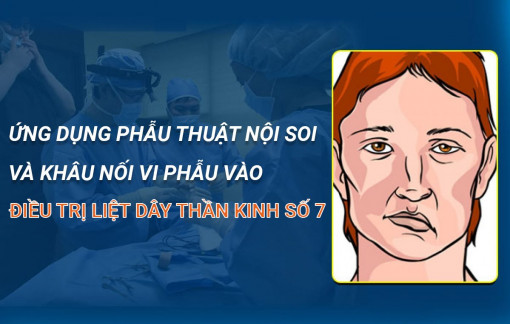 Ứng dụng phẫu thuật nội soi và khâu nối vi phẫu vào điều trị liệt dây thần kinh số 7