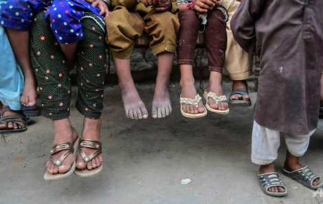 Cơ sở y tế tái sử dụng kim tiêm sai cách, hơn 1.500 trẻ em Pakistan nhiễm HIV