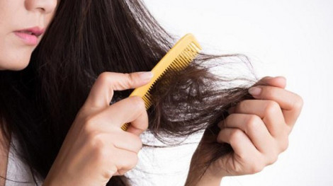 Rụng tóc nhiều vào mùa hè có phải bệnh?
