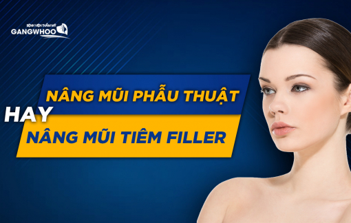 Nâng mũi, nên chọn phẫu thuật hay tiêm filler?