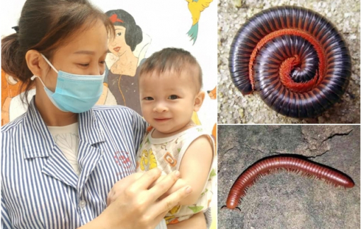 Nhầm con cuốn chiếu là đồ ăn, bé trai 9 tháng tuổi cho vào miệng gây ngộ độc