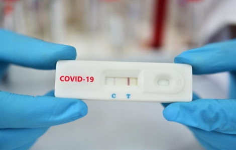Sở Y tế TPHCM yêu cầu chấn chỉnh việc mua bán test nhanh chẩn đoán COVID-19