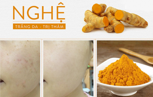 Cùng Bikipdepxinh tìm hiểu công dụng của kem nghệ