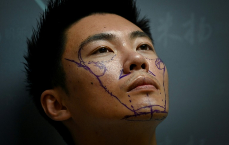 Đàn ông Trung Quốc tìm đến phẫu thuật thẩm mỹ để mong thêm cơ hội trong cuộc sống