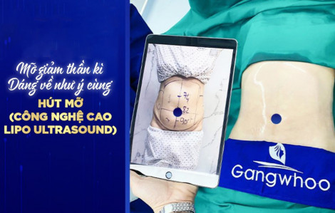 Niềm hạnh phúc vỡ òa của người phụ nữ U40 nhờ hút mỡ công nghệ cao Lipo Ultrasound