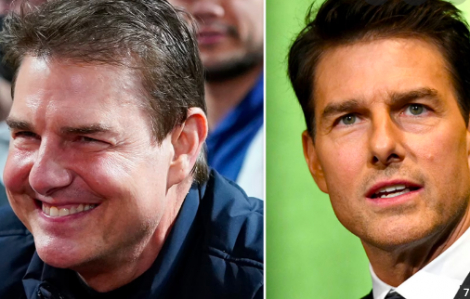 Tom Cruise mặt tròn vo, bị nghi tiêm chất làm đầy