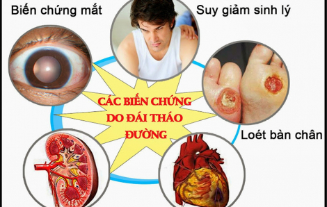 Tuân thủ điều trị giúp giảm tử vong do bệnh mạn tính