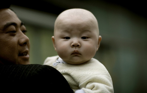 Cha mẹ Trung Quốc “nắn” đầu tròn cho con để được... may mắn