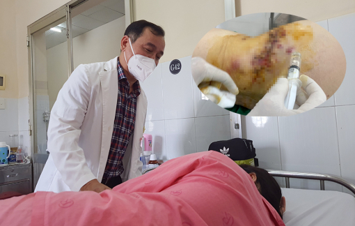 Tiêm thuốc tan mỡ để giảm cân, cô gái trẻ bị rách da từng mảng
