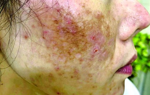 Những khái niệm làm đẹp bị đánh tráo