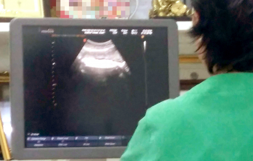 Muốn sinh mổ sớm vì sợ con gái tuổi Dần