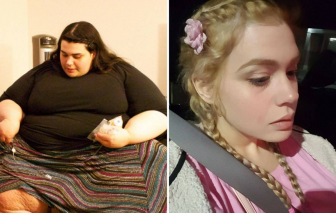 Cô gái 32 tuổi giảm cân đến 181kg