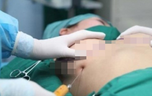 Sở Y tế TPHCM báo cáo vụ tử vong sau nâng ngực tại Bệnh viện 1A