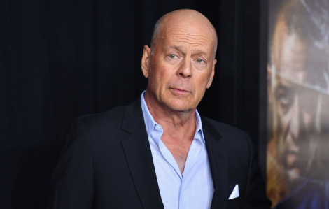 Bruce Willis mắc chứng mất ngôn ngữ khi sự nghiệp đang đỉnh cao