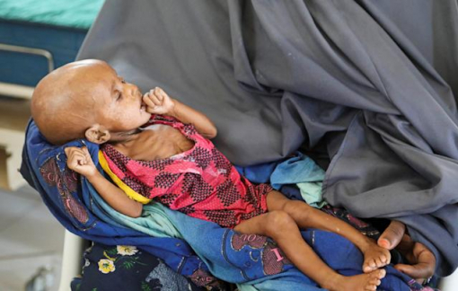 350.000 trẻ em Somalia có nguy cơ chết đói do hạn hán