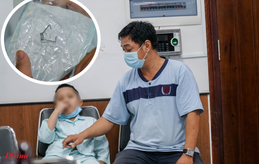 Hy hữu, bé trai bị chiếc lò xo móc vào thanh quản