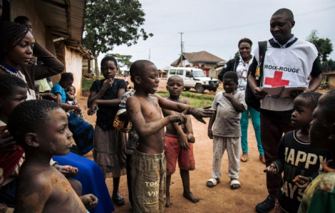Bùng phát dịch Ebola tại Congo