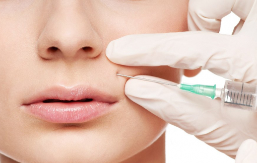 Đang tiêm filler xóa nhăn, hoảng loạn vì đầu kim gãy cắm sâu vào người