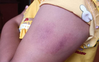 Đắk Lắk: Học sinh lớp 1 bị cô giáo đánh vì không hoàn thành bài kiểm tra